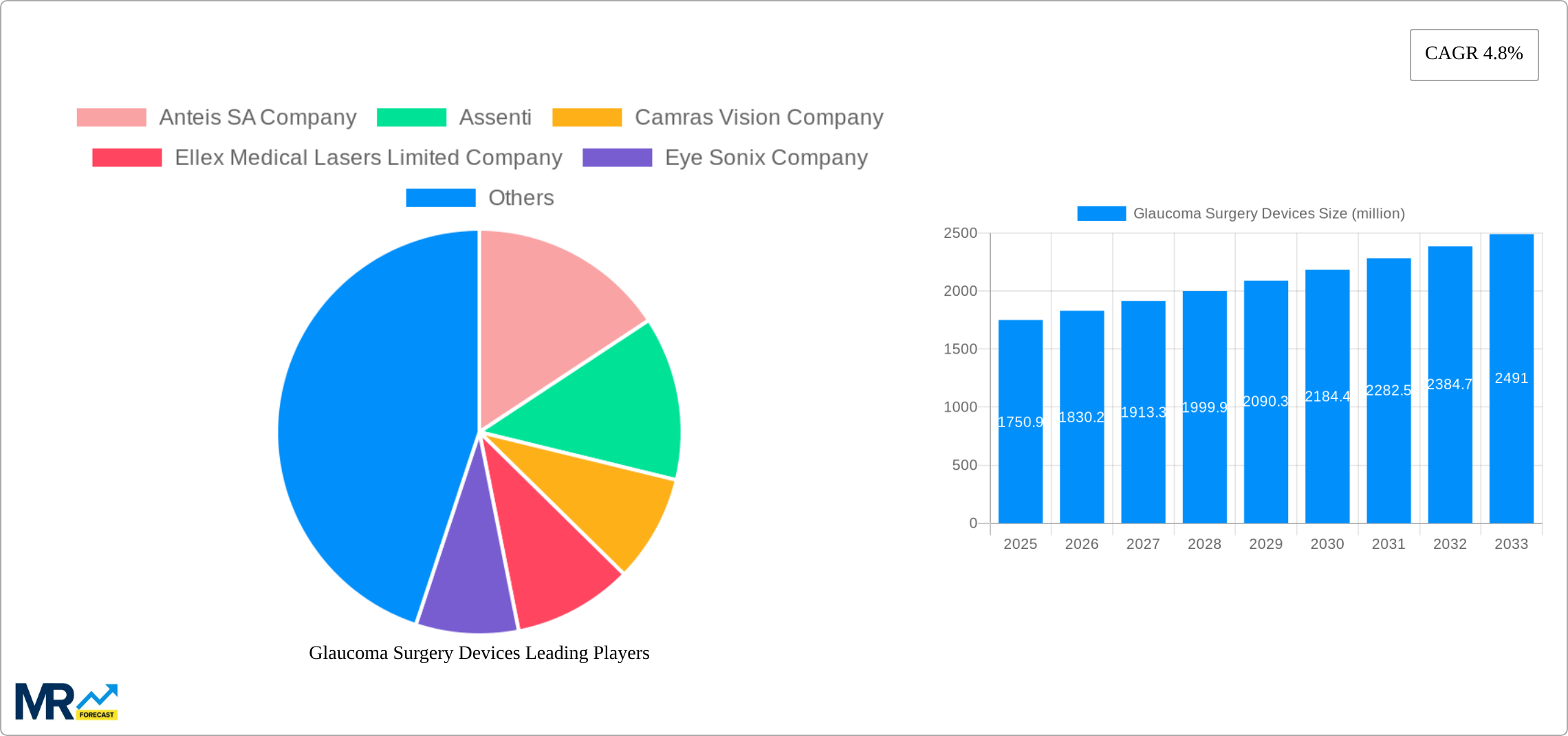 Glaucoma Surgery Devices Research Report - Market Size, Growth & Forecast